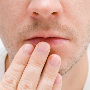 How long do Cold Sores Last?